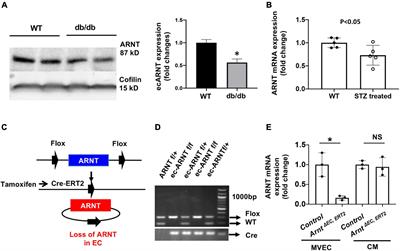 Endothelial Aryl Hydrocarbon Receptor Nuclear Translocator Mediates the Angiogenic Response to Peripheral Ischemia in Mice With Type 2 Diabetes Mellitus